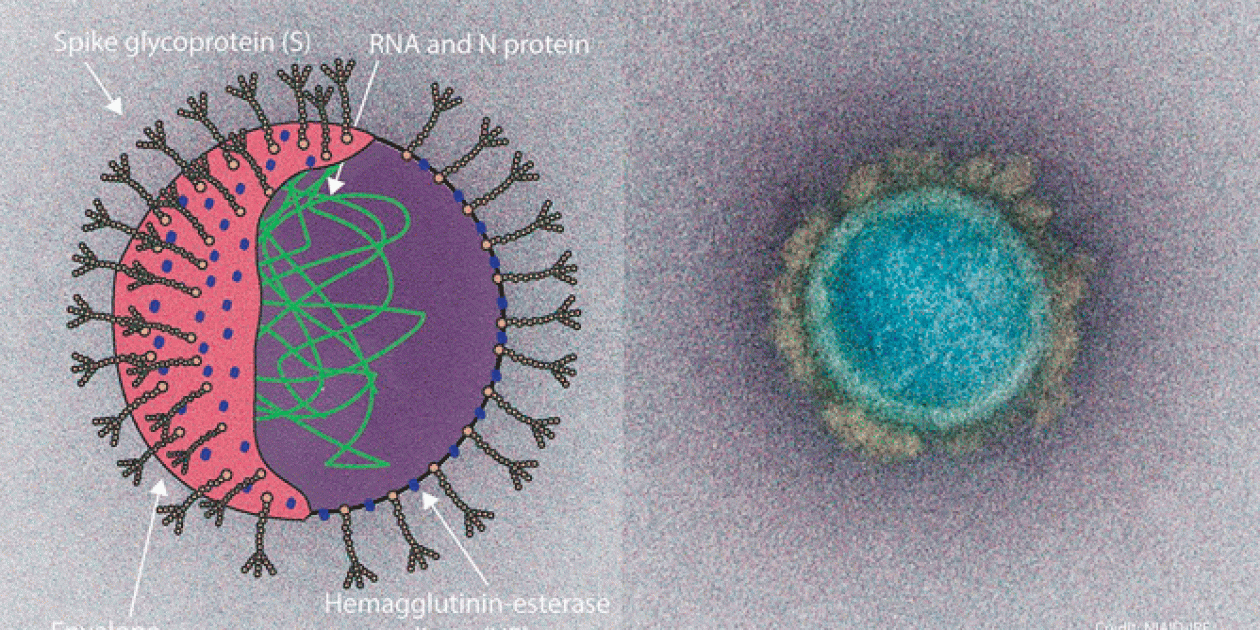 Pandemia de coronavirus: consideraciones del entorno construido para reducir la transmisión  