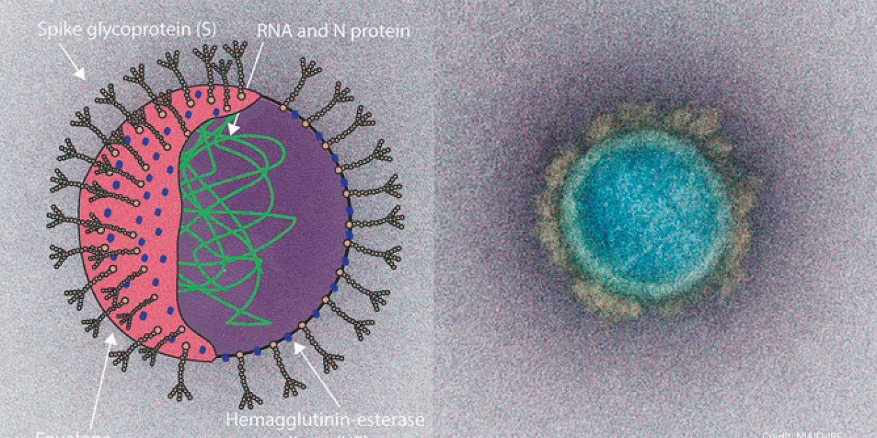 Pandemia de coronavirus: consideraciones del entorno construido para reducir la transmisión