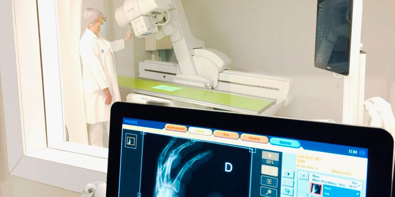 Asepeyo instala un equipo de radiología pionero en el mundo