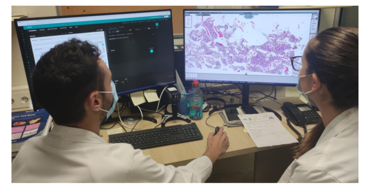 El Sistema de imagen médica digital de Catalunya incorpora la anatomía patológica