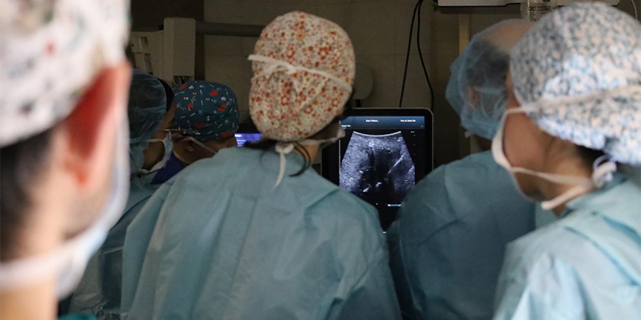 La electroporación, nueva herramienta del Hospital del Mar para abordar tumores complejos de hígado y páncreas