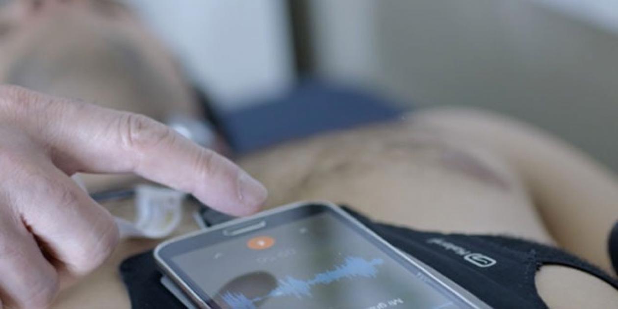Un teléfono inteligente para detectar la apnea del sueño en casa